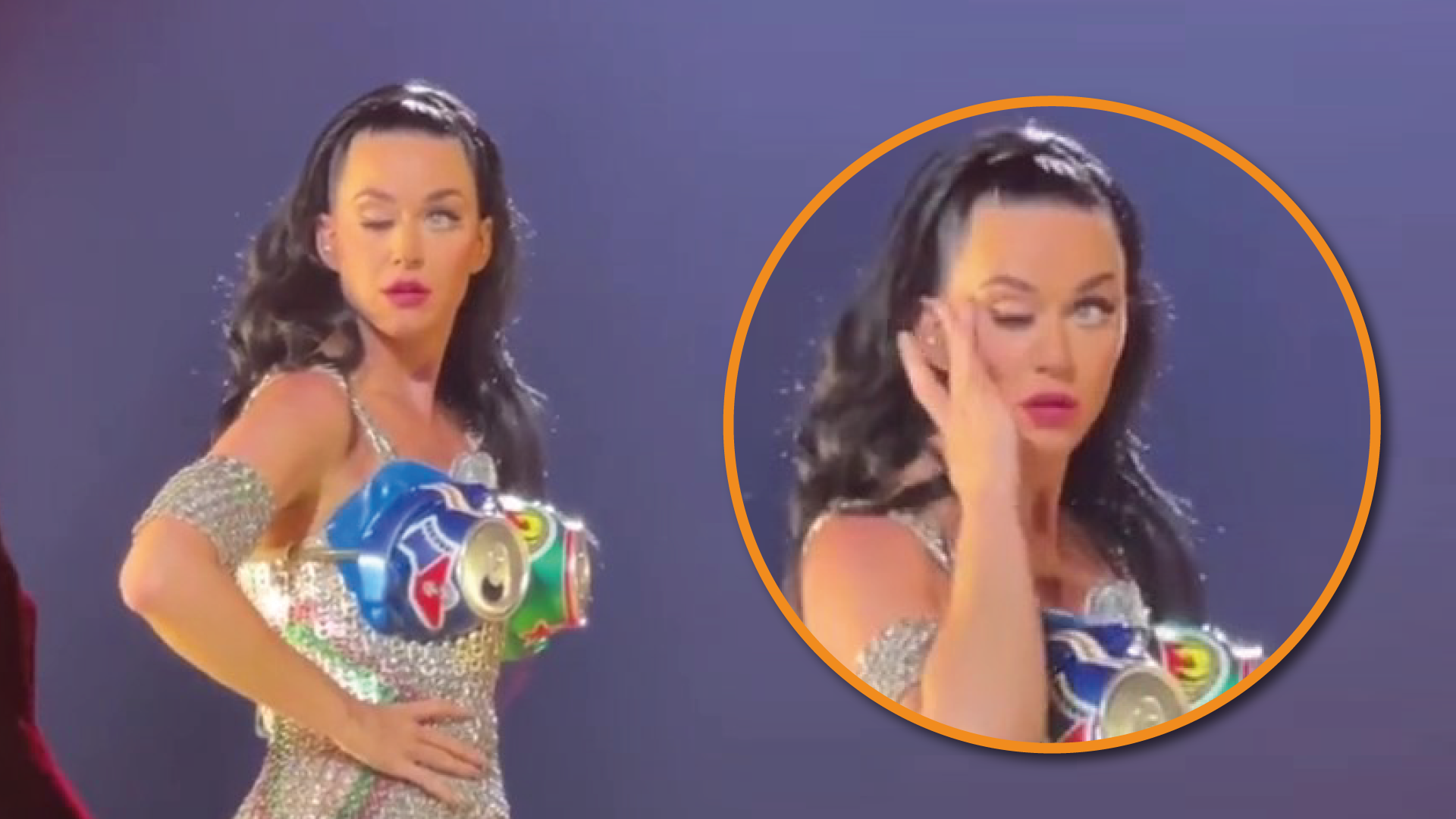 Katy Perry explica o que exatamente aconteceu com seu olho (Vídeo)