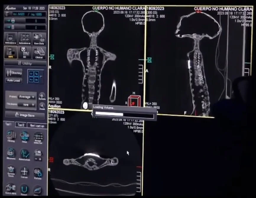 tomografias computadorizadas de clara