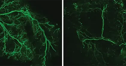 Ativação cerebral prolonga vida de camundongos