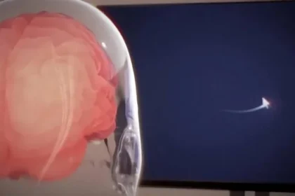 Paciente da Neuralink pode mover mouse com o pensamento