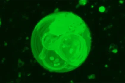 Como se formaram as primeiras células da Terra. Vesículas em uma estrutura semelhante a uma protocélula. (Pesquisa Scripps)
